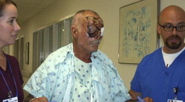 Revelan condición médica de la Víctima del ataque del 'Caníbal de Miami'