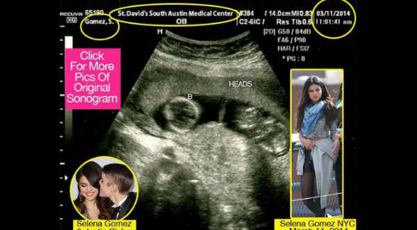 Foto: ¿Selena Gomez embarazada de Justin Bieber?