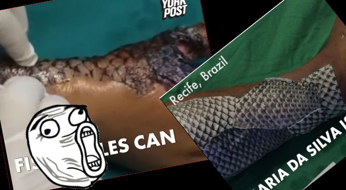 YouTube: Cubrió sus quemaduras con escamas de pescado y este fue el resultado