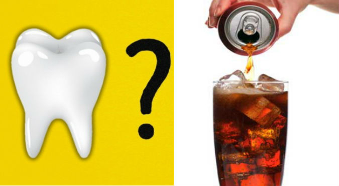Viral: ¿Tomas mucha gaseosa? Tus dientes serán los más afectados y quedarán así