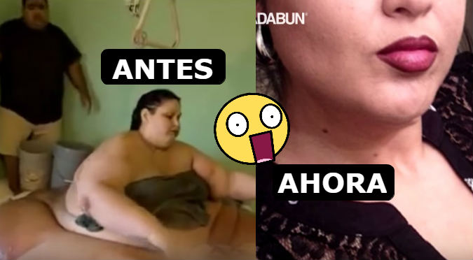 Así luce ahora la mujer más gorda de la historia (VIDEO)