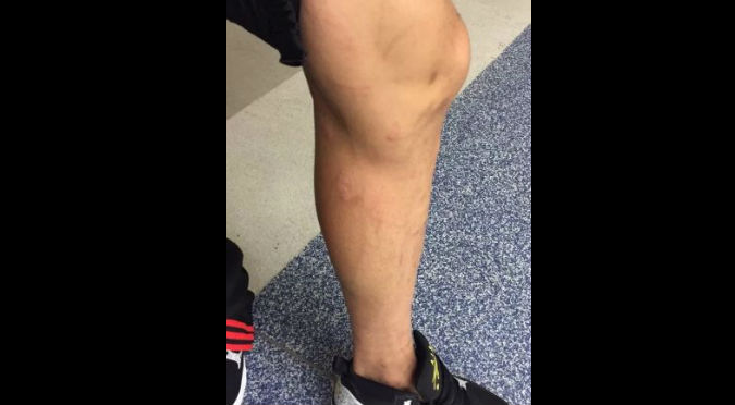 Mira cómo quedó la pierna de Paolo Guerrero luego de su último enfrentamiento- FOTO