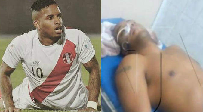 Jefferson Farfán: César Távara fue hospitalizado de emergencia