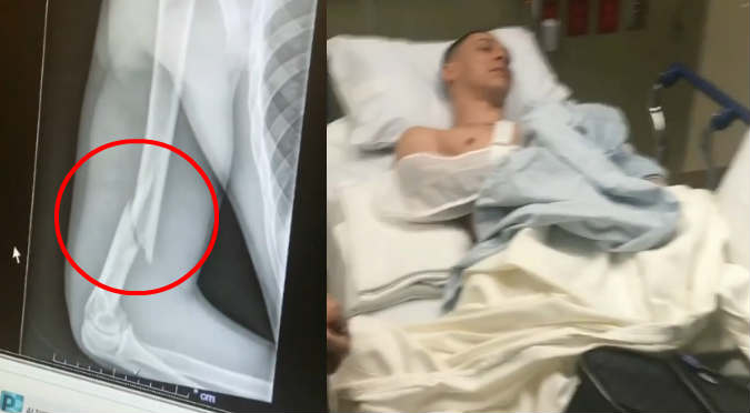 Reggaetonero quedó con el brazo roto tras accidente de tránsito
