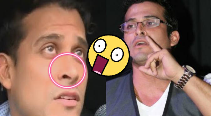Christian Domínguez recibe tremendo golpe en la nariz y reaccionó así (VIDEO)