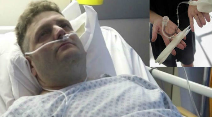 Hombre quedó en coma tras perder su virginidad (VIDEO)