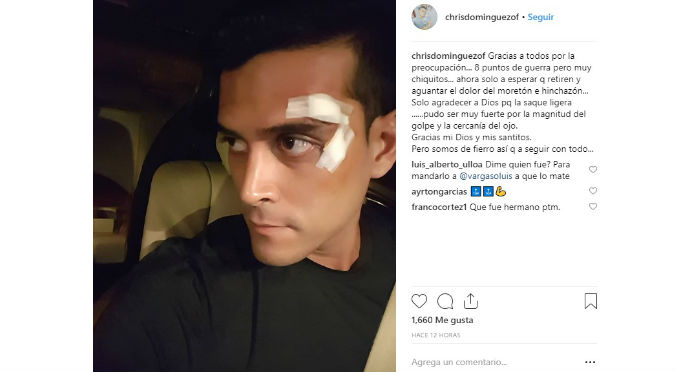 Christian Domínguez muestra su cambiado rostro tras terrible accidente
