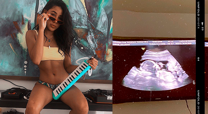 Samahara Lobatón confirma embarazo y comparte ecografía de su bebé | FOTO