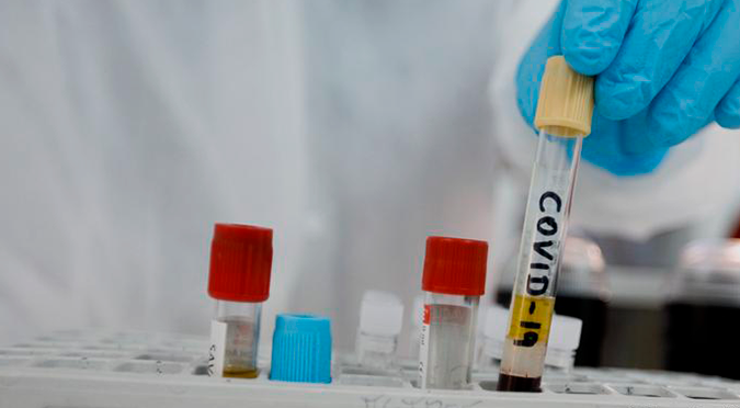 Vacuna COVID-19: amplían número de inscritos para ensayos clínicos