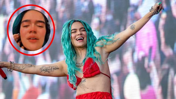 Karol G: la extraña enfermedad que le diagnosticaron a la cantante | VIDEO