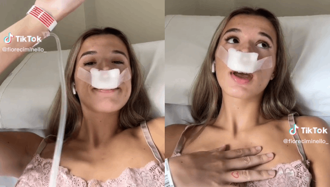 Tiktoker se hace la rinoplastia para que sus hijos nazcan con una linda nariz | VIDEO