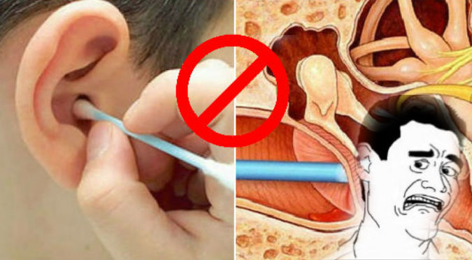 ¿Te limpias los oídos con hisopos? Dejarás de hacerlo al saber esto – VIDEO