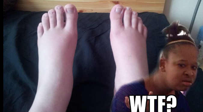 ¡Ni te imaginas por qué sus pies se hicieron virales! – FOTOS