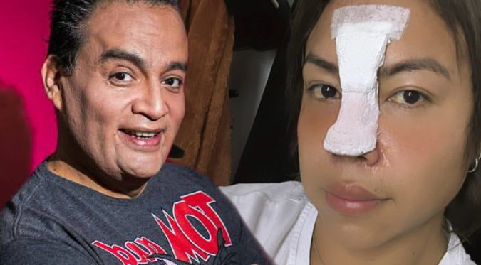 Dayanita se hace una rinoplastia en medio de deuda con JB, supuesta estafa y pollada: “Mi naricita”
