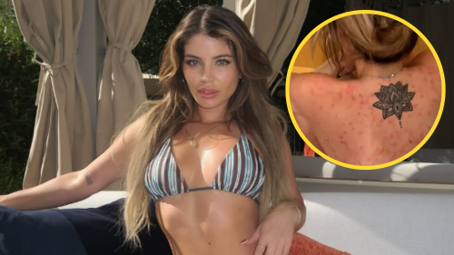 Flavia Laos confiesa que le detectaron una delicada enfermedad incurable: “No se sabe la causa”