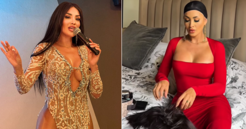 ¡Rompe su silencio! Michelle Soifer revela el motivo por el que empezó a usar pelucas